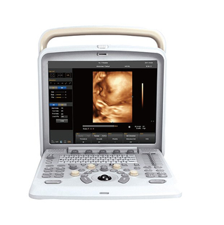 Q5 4D Tragbarer Farbdoppler