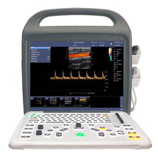 PT5200 Tragbarer Farbdoppler-Ultraschallscanner